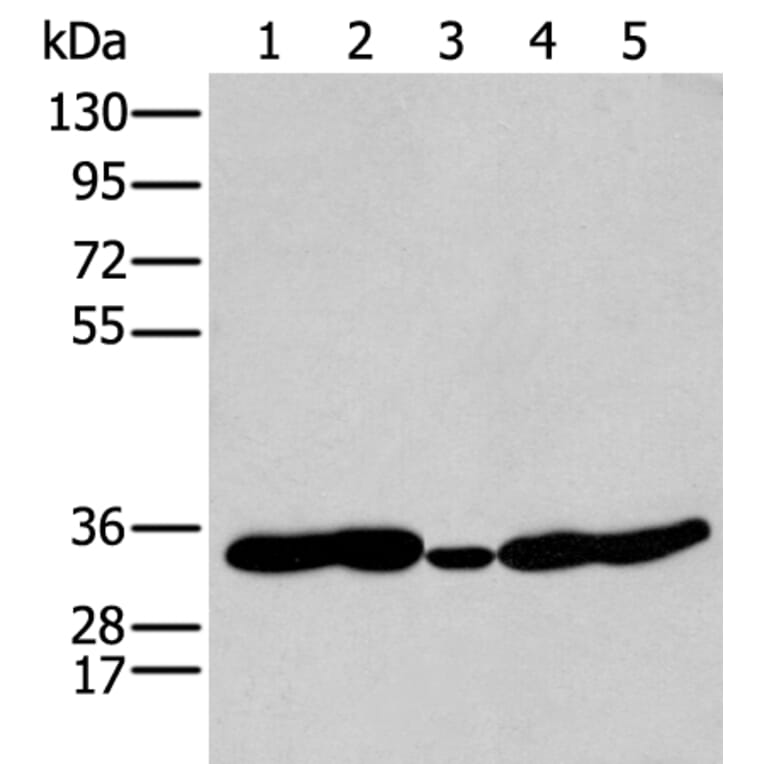 HOXC11 Antibody from Signalway Antibody (43932) - Antibodies.com