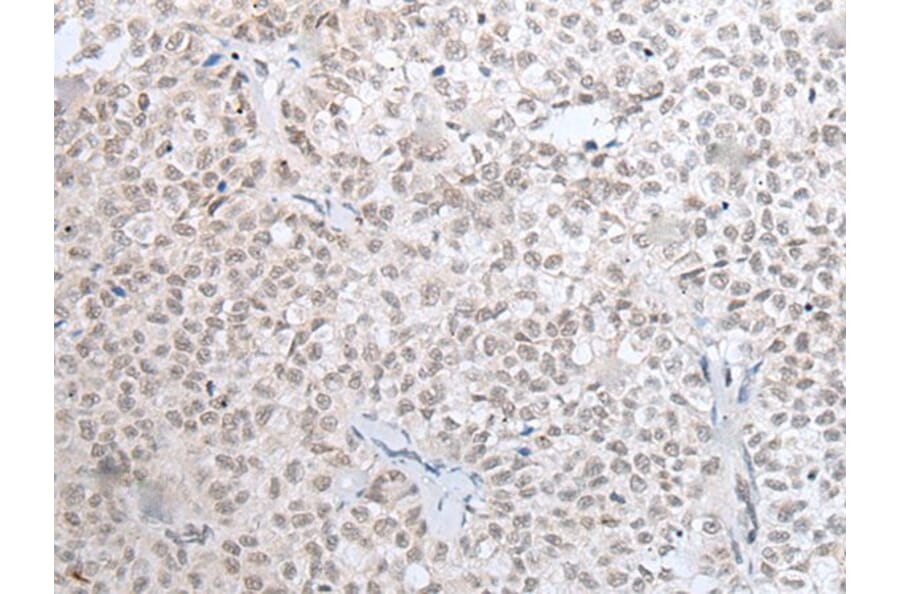 HOXC11 Antibody from Signalway Antibody (43932) - Antibodies.com