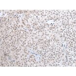 HOXC11 Antibody from Signalway Antibody (43932) - Antibodies.com