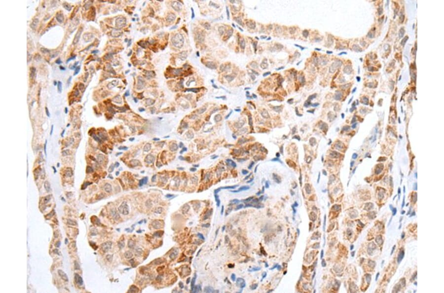 HOXC11 Antibody from Signalway Antibody (43932) - Antibodies.com