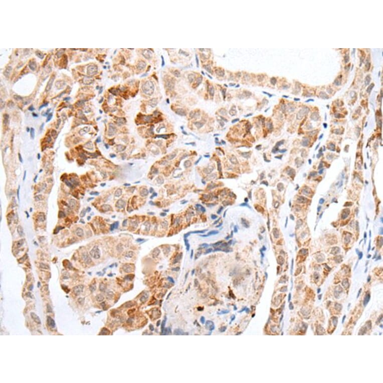 HOXC11 Antibody from Signalway Antibody (43932) - Antibodies.com