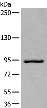 Gel: 6%SDS-PAGE Lysate: 40 &#956;g, Lane: Jurkat cell lysate, Primary antibody: ZBTB10 antibody at dilution 1/800, Secondary antibody: Goat anti rabbit IgG at 1/8000 dilution, Exposure time: 40 seconds