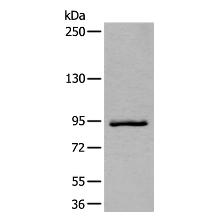 ZBTB10 Antibody from Signalway Antibody (43967) - Antibodies.com
