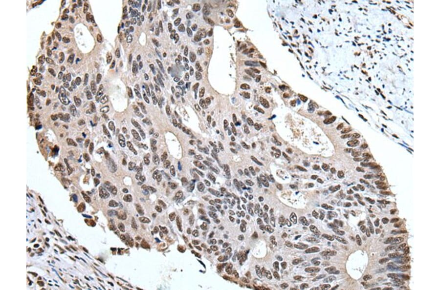 ZBTB10 Antibody from Signalway Antibody (43967) - Antibodies.com