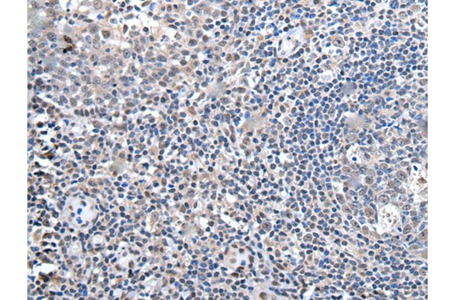 ZBTB10 Antibody from Signalway Antibody (43967) - Antibodies.com