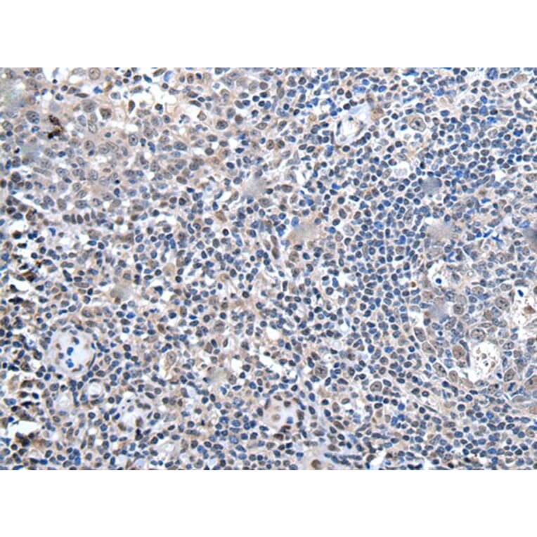 ZBTB10 Antibody from Signalway Antibody (43967) - Antibodies.com