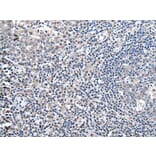 ZBTB10 Antibody from Signalway Antibody (43967) - Antibodies.com