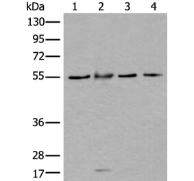 WDSUB1 Antibody from Signalway Antibody (43977) - Antibodies.com