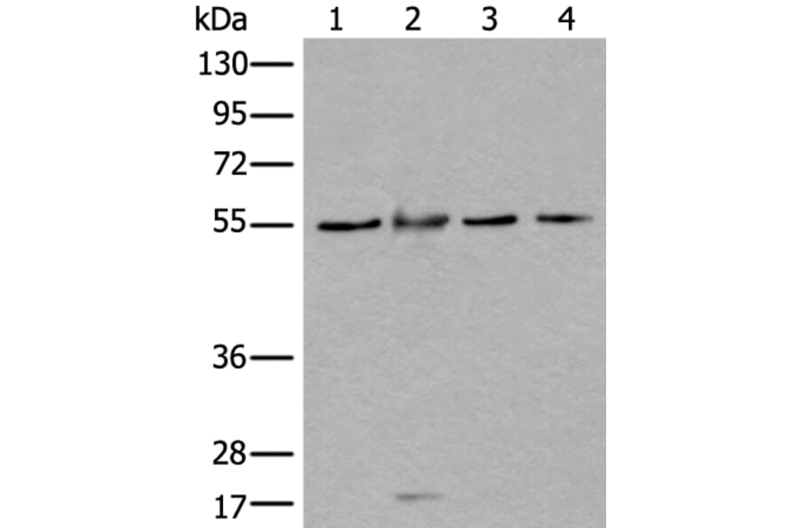 WDSUB1 Antibody from Signalway Antibody (43977) - Antibodies.com