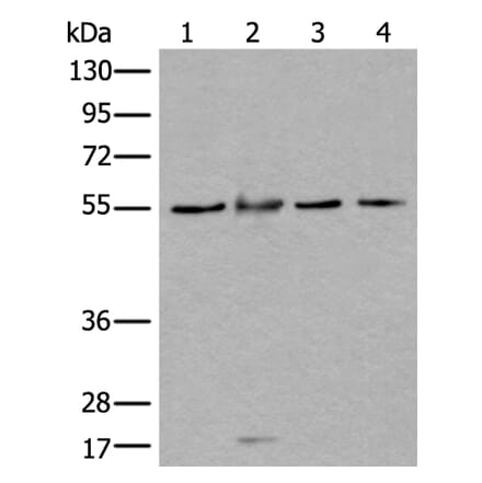WDSUB1 Antibody from Signalway Antibody (43977) - Antibodies.com