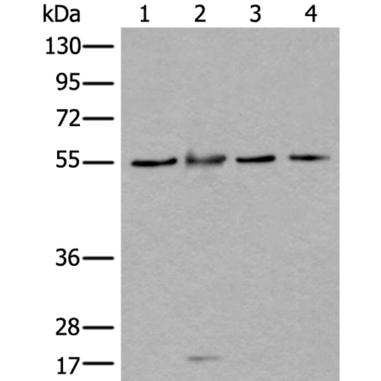 WDSUB1 Antibody from Signalway Antibody (43977) - Antibodies.com