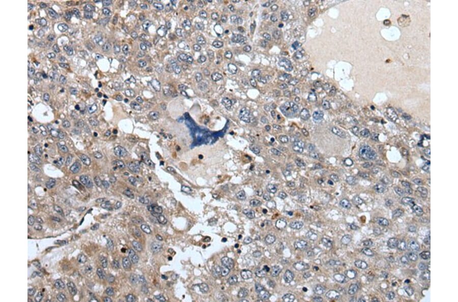 WDSUB1 Antibody from Signalway Antibody (43977) - Antibodies.com