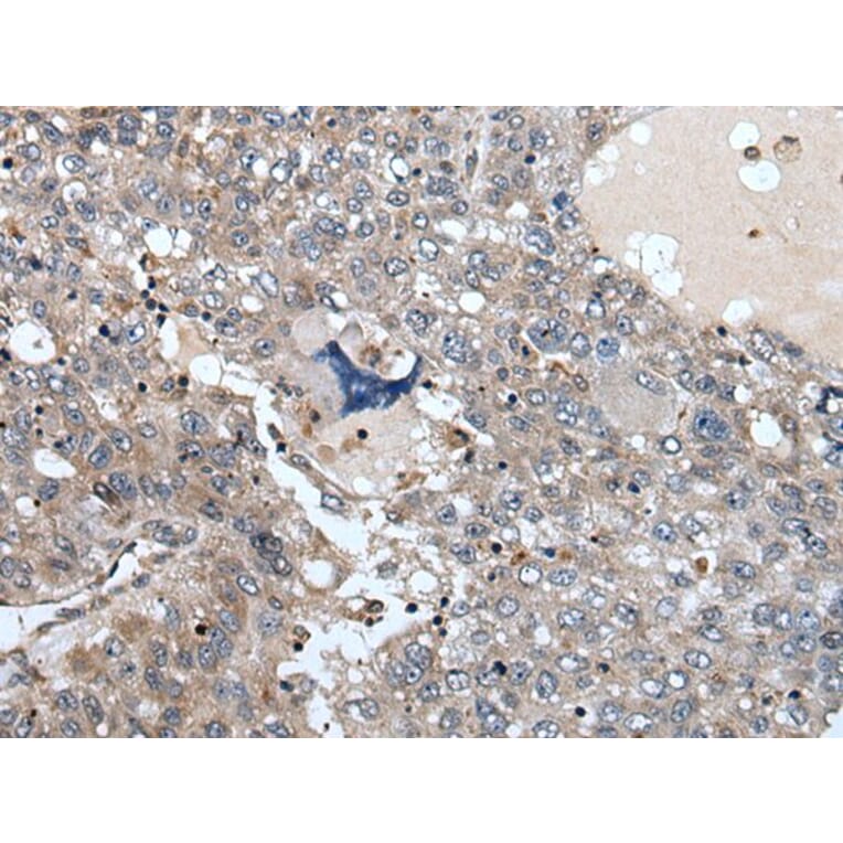 WDSUB1 Antibody from Signalway Antibody (43977) - Antibodies.com