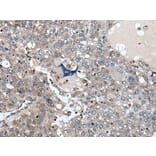 WDSUB1 Antibody from Signalway Antibody (43977) - Antibodies.com