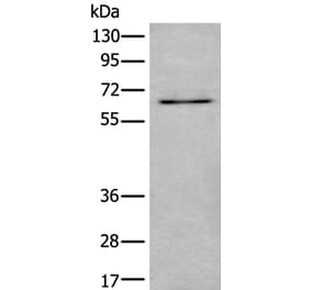 UBQLN2 Antibody from Signalway Antibody (43986) - Antibodies.com