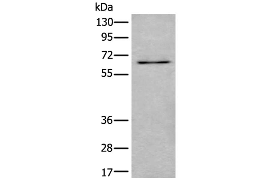 UBQLN2 Antibody from Signalway Antibody (43986) - Antibodies.com