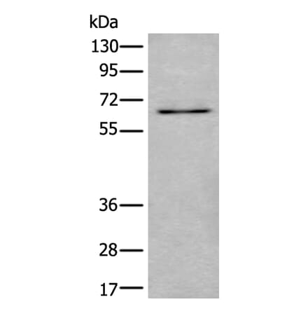 UBQLN2 Antibody from Signalway Antibody (43986) - Antibodies.com