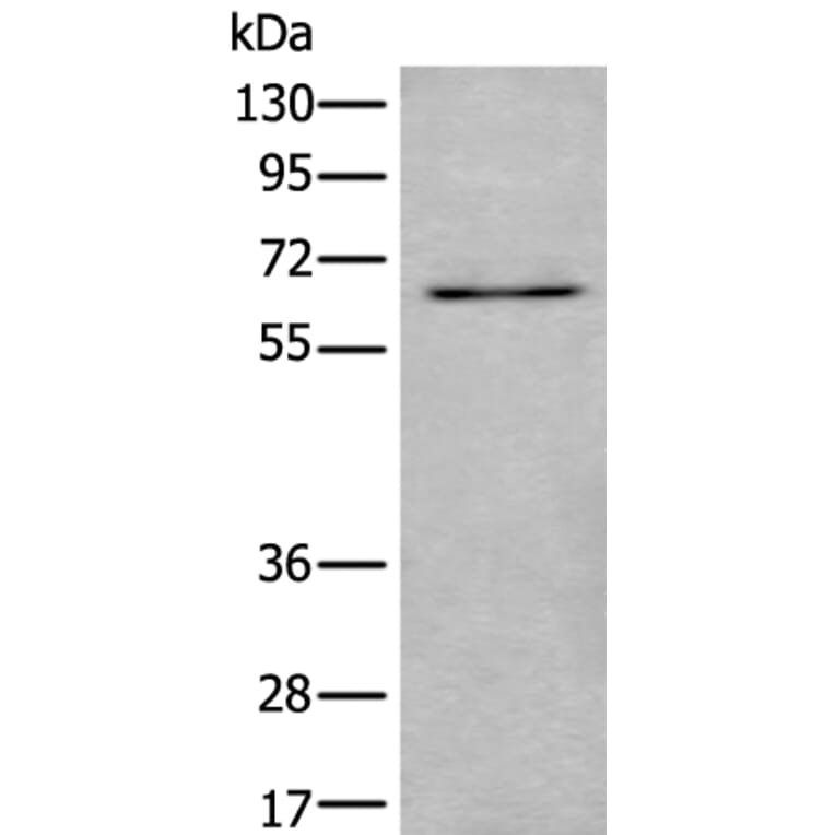 UBQLN2 Antibody from Signalway Antibody (43986) - Antibodies.com