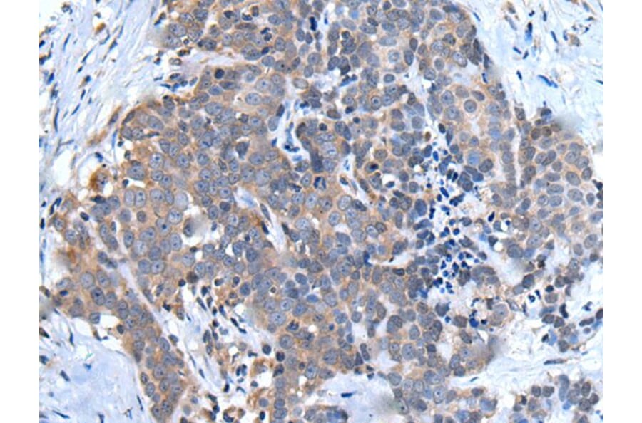 UBQLN2 Antibody from Signalway Antibody (43986) - Antibodies.com