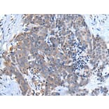 UBQLN2 Antibody from Signalway Antibody (43986) - Antibodies.com