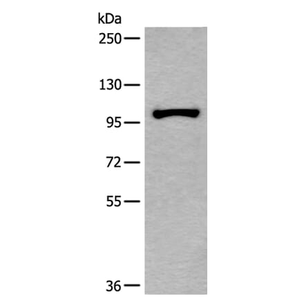 HELLS Antibody from Signalway Antibody (43539) - Antibodies.com