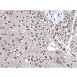 HELLS Antibody from Signalway Antibody (43539) - Antibodies.com