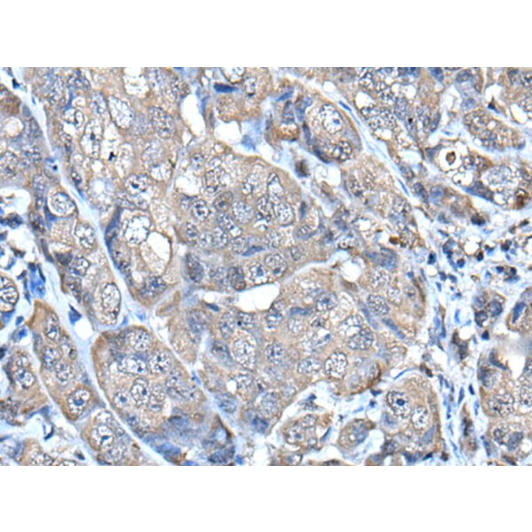 HELLS Antibody from Signalway Antibody (43539) - Antibodies.com