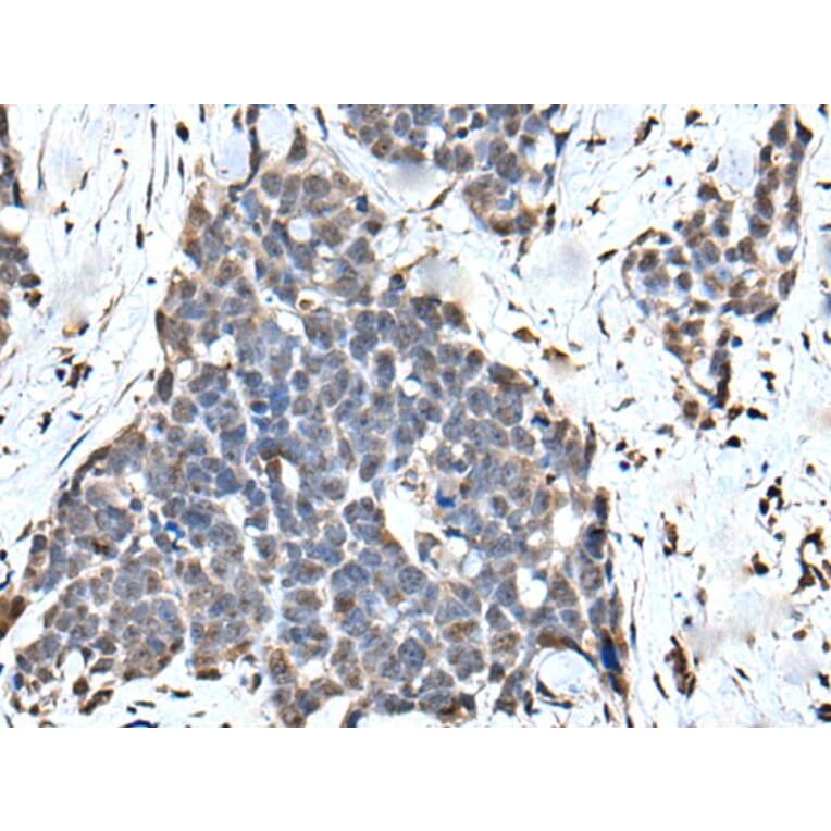 ATF6B Antibody from Signalway Antibody (43545) - Antibodies.com