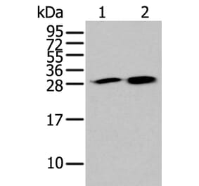 HDHD2 Antibody from Signalway Antibody (43563) - Antibodies.com