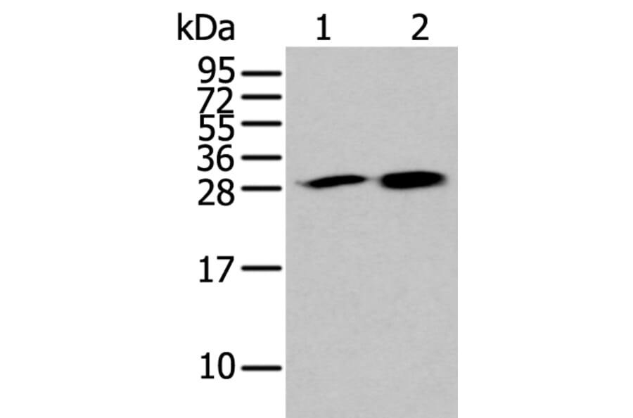 HDHD2 Antibody from Signalway Antibody (43563) - Antibodies.com