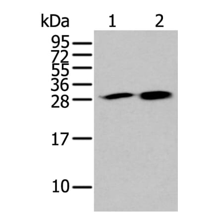 HDHD2 Antibody from Signalway Antibody (43563) - Antibodies.com