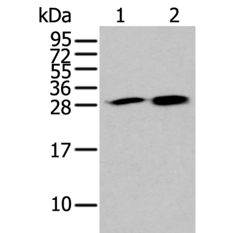 HDHD2 Antibody from Signalway Antibody (43563) - Antibodies.com