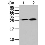 HDHD2 Antibody from Signalway Antibody (43563) - Antibodies.com