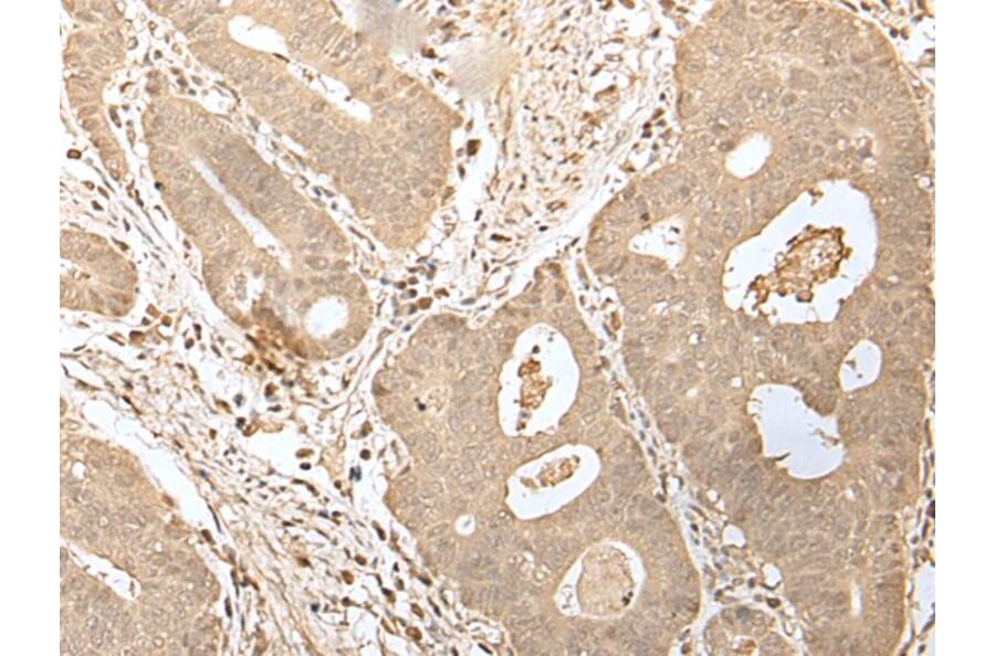 HDHD2 Antibody from Signalway Antibody (43563) - Antibodies.com