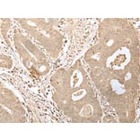 HDHD2 Antibody from Signalway Antibody (43563) - Antibodies.com