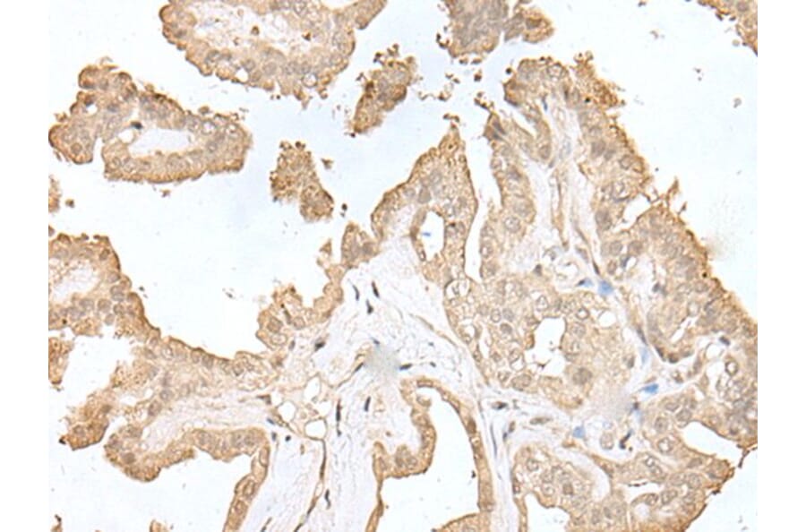 HDHD2 Antibody from Signalway Antibody (43563) - Antibodies.com