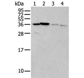 LASP1 Antibody from Signalway Antibody (43565) - Antibodies.com
