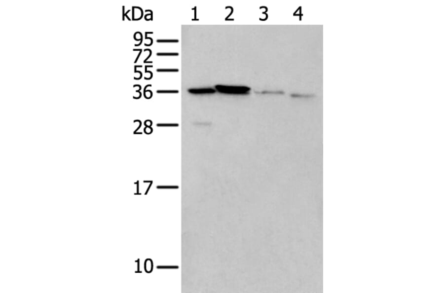 LASP1 Antibody from Signalway Antibody (43565) - Antibodies.com