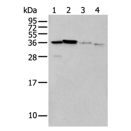 LASP1 Antibody from Signalway Antibody (43565) - Antibodies.com