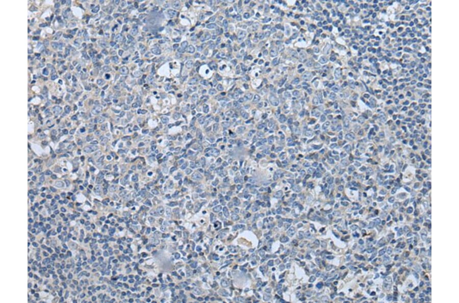 LASP1 Antibody from Signalway Antibody (43565) - Antibodies.com