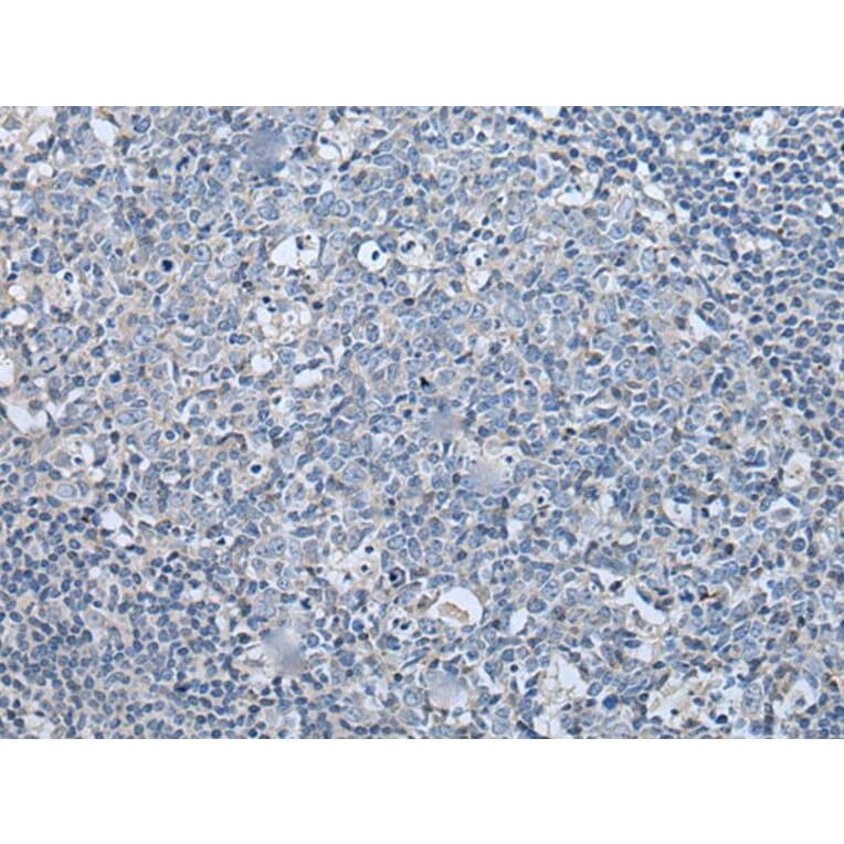 LASP1 Antibody from Signalway Antibody (43565) - Antibodies.com