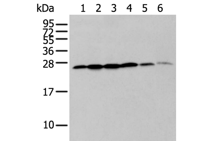 ZMAT2 Antibody from Signalway Antibody (43571) - Antibodies.com