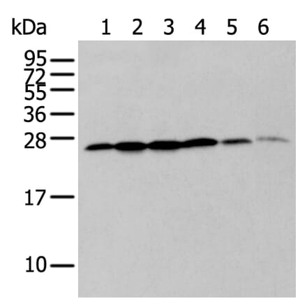 ZMAT2 Antibody from Signalway Antibody (43571) - Antibodies.com