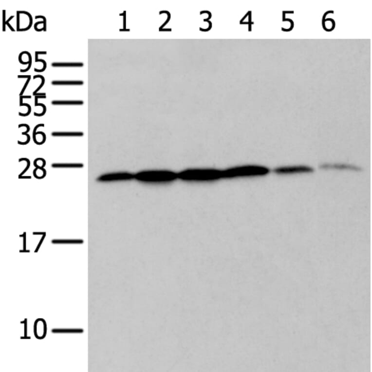 ZMAT2 Antibody from Signalway Antibody (43571) - Antibodies.com