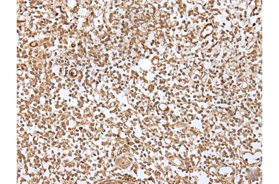 ZMAT2 Antibody from Signalway Antibody (43571) - Antibodies.com