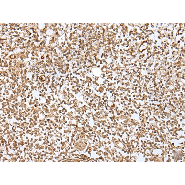 ZMAT2 Antibody from Signalway Antibody (43571) - Antibodies.com