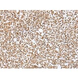 ZMAT2 Antibody from Signalway Antibody (43571) - Antibodies.com