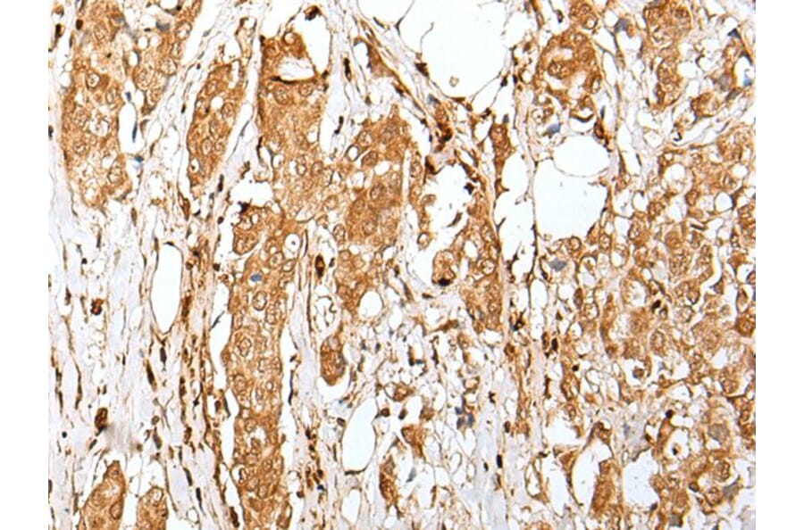 ZMAT2 Antibody from Signalway Antibody (43571) - Antibodies.com