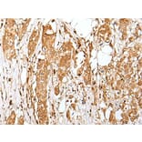 ZMAT2 Antibody from Signalway Antibody (43571) - Antibodies.com