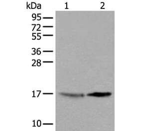 UBE2W Antibody from Signalway Antibody (43601) - Antibodies.com